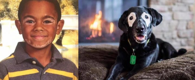 : https://www.besame.fm/2019/carter-el-nino-que-supero-la-depresion-gracias-un-perro-con-su-misma-condicion-68589.html