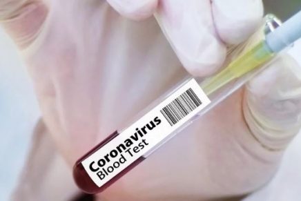 Las vacunas que está desarrollando la ciencia para combatir el coronavirus