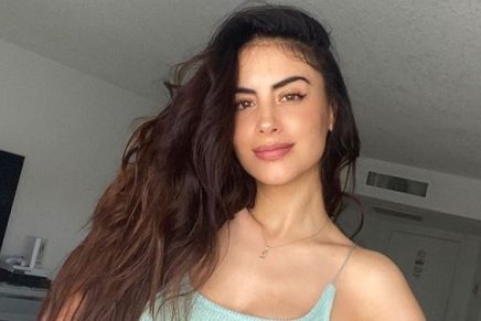Jessica Cediel publicó una foto de su nalga después de 6 meses de su cirugía