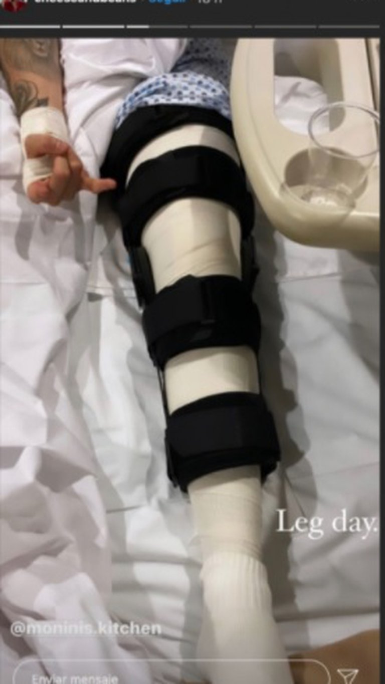 Cantante del grupo Jesse & Joy sufrió un fuerte accidente y tuvo que ser operado de emergencia