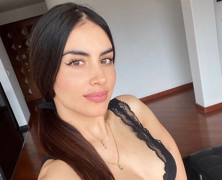 Jessica Cediel mostró, sin pena y con poca ropa, las secuelas por los biopolímeros