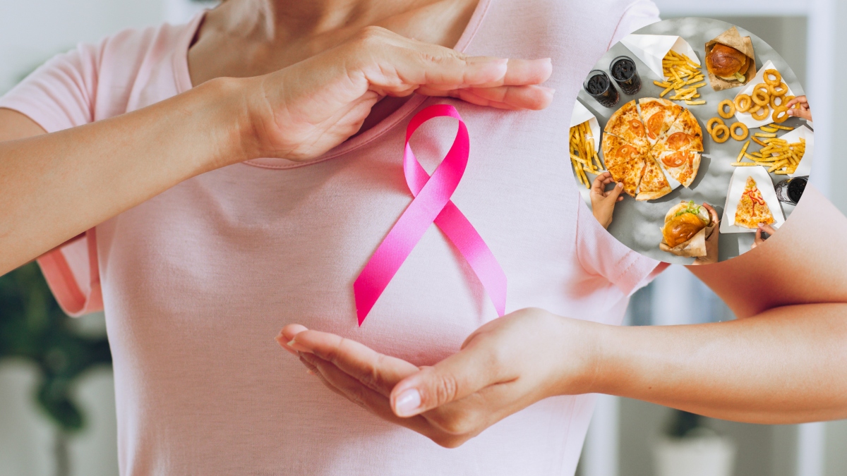 Alimentos que aumentan el riesgo de cáncer de mama - Getty Images