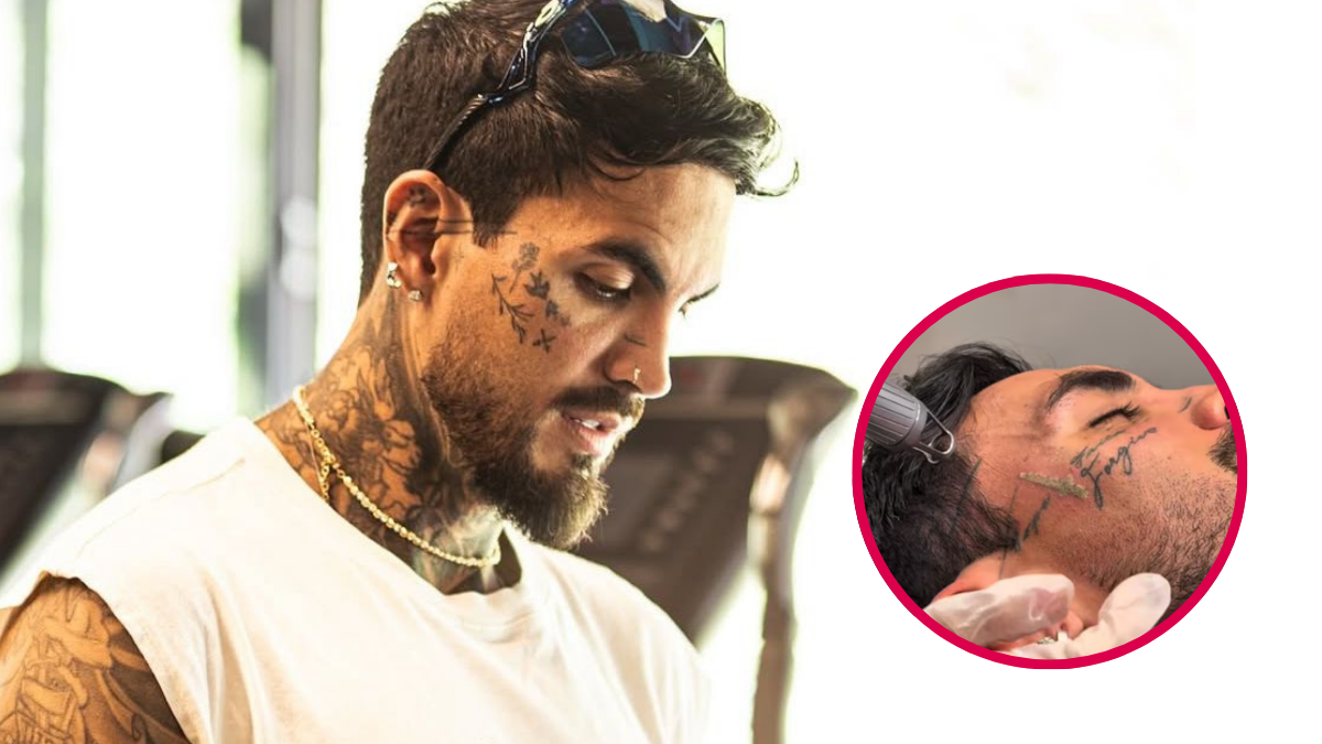 Mateo Carvajal en el procedimiento para borrarse los tatuajes. Crédito: @mateoc17