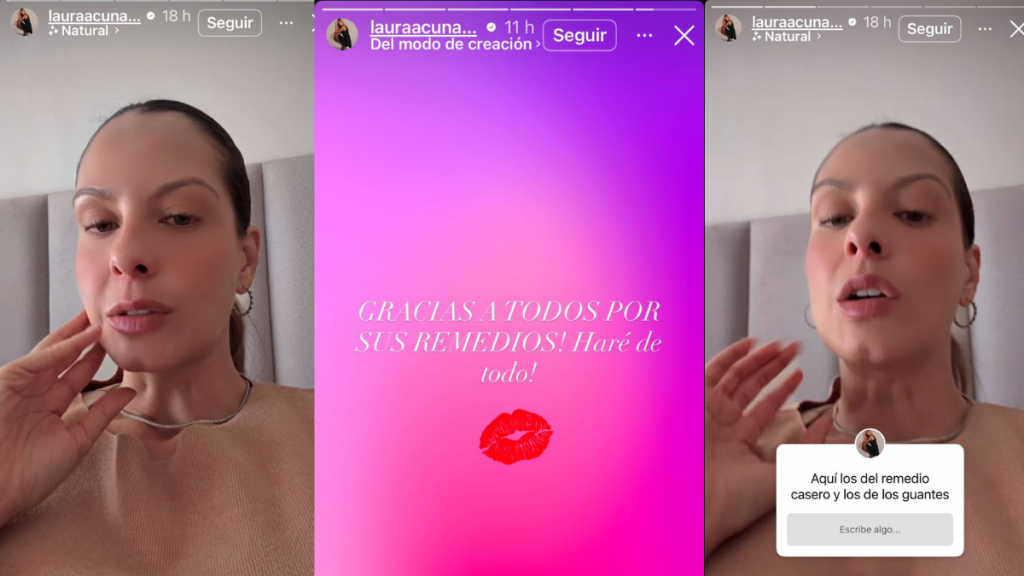 Historias de la presentadora Laura Acuña, sobre su estado de salud. | Crédito: @Lauraacunaayala